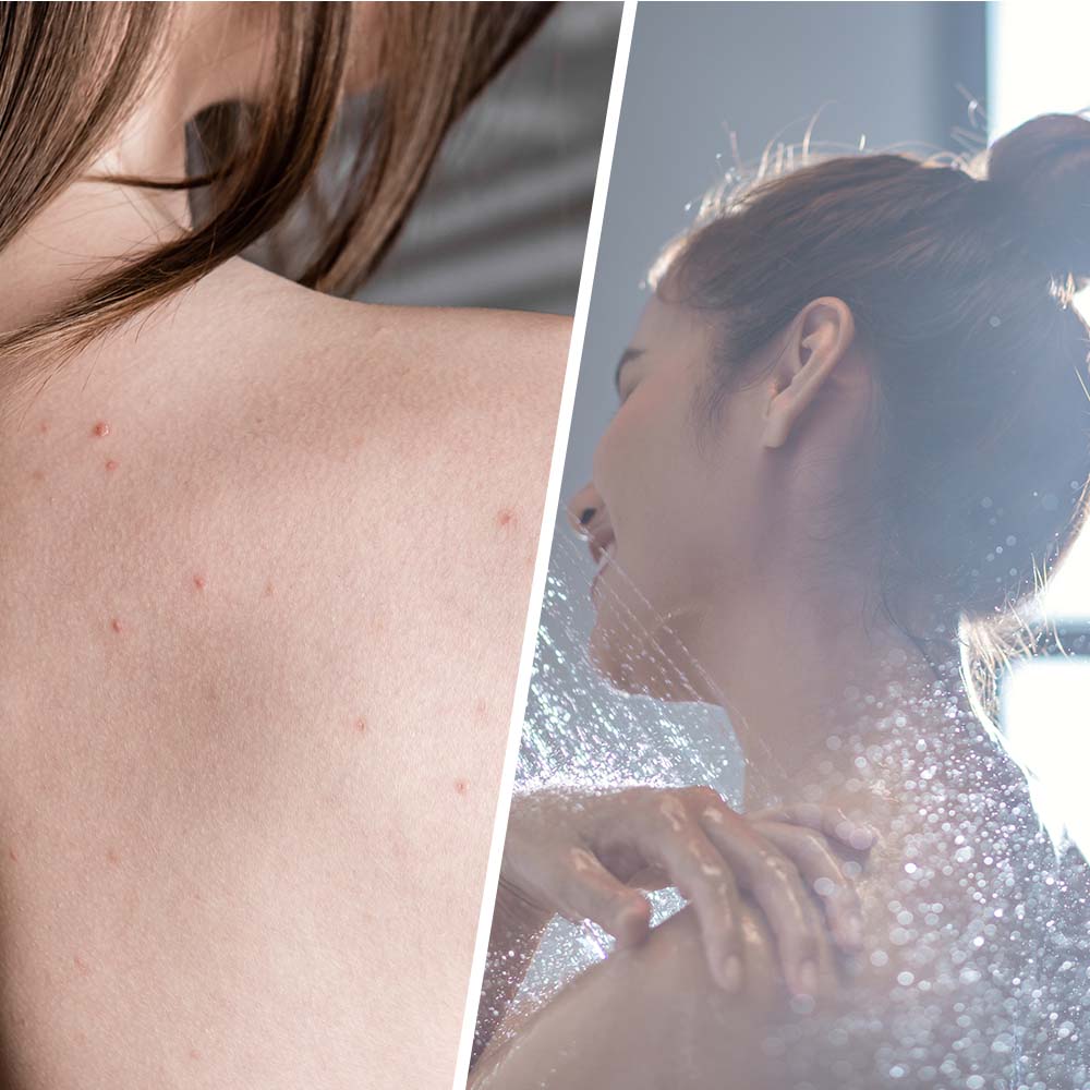 SALICYLIC BLEMISH SCRUB Detoxifying Organic Tea Tree Sugar & Talasso Body Exfoliator